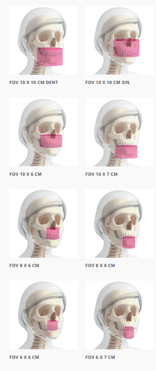 3D MULTİFOV (8 FOV SEÇENEĞİ)