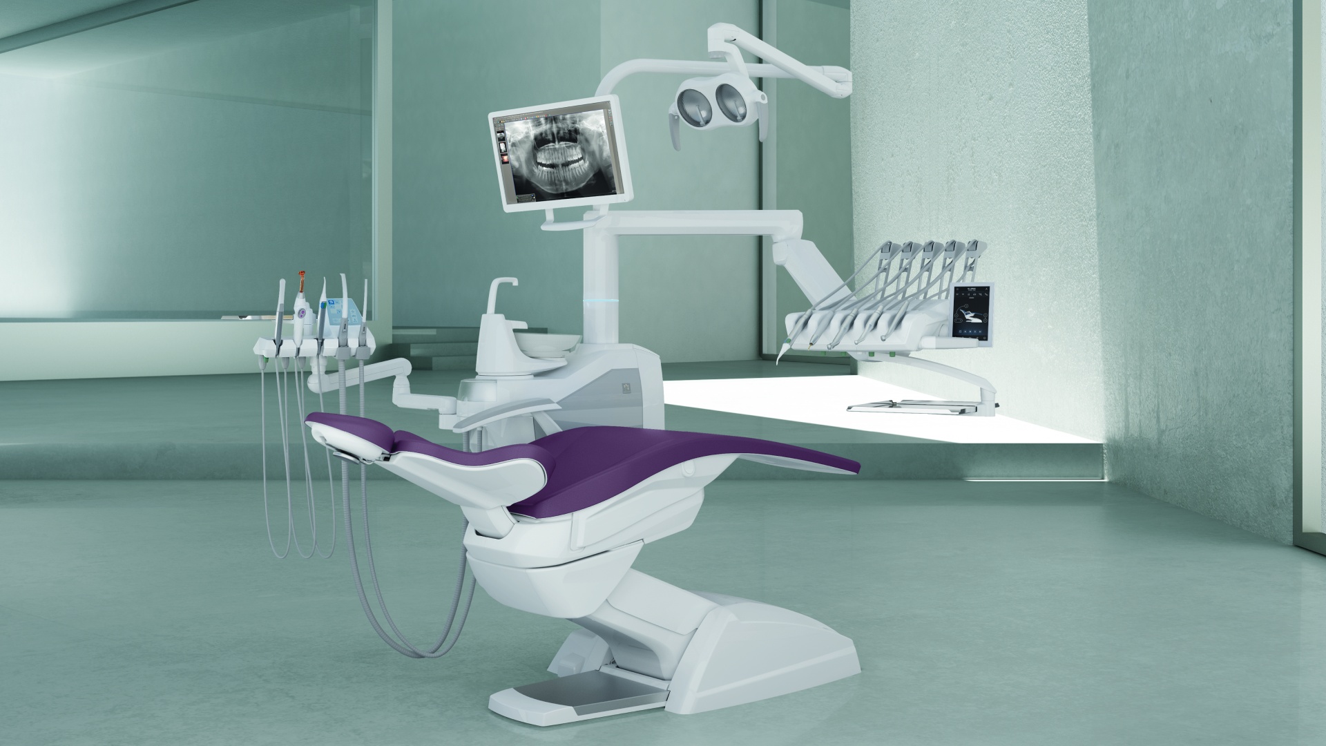Stern Weber S300